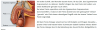 upload_2015-1-16_0-59-6.png upload_2015-1-16_0-59-6.png