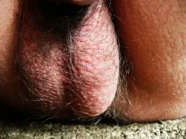 balls483.webp