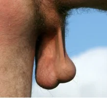 balls491.webp