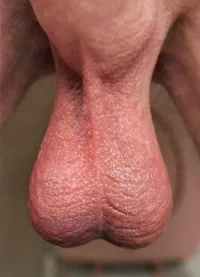 balls498.webp