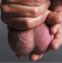 balls279.jpg