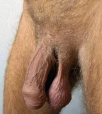 bolas 4.webp