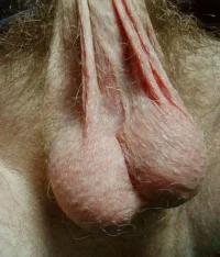 balls314.webp