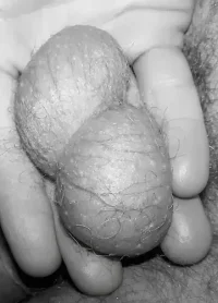 balls404.webp