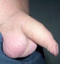schlaff 012.webp