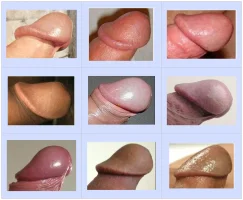 chart-7b.webp