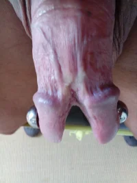 eichel piercing 003.webp