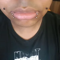Snake Bites.webp