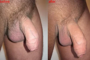 beforeandafter-txt.webp
