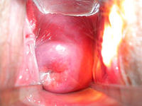 220px-Cervix.jpg