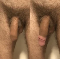 Uncut_penis_with_foreskin_on_and_rolled_back.webp