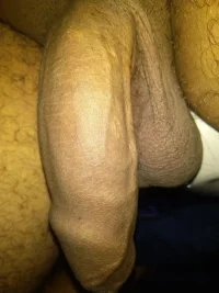 018_1000.webp