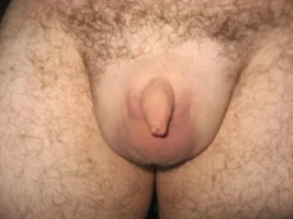 little wee micro penis.webp
